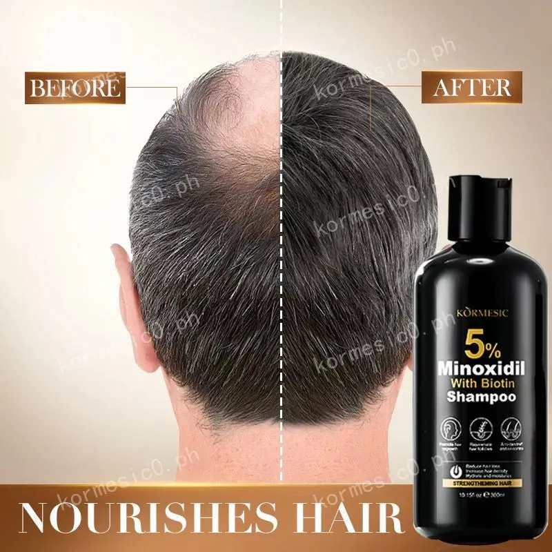 KORMESIC Minoxidil with Biotin Hair Grower Shampoo And Conditioner 300ml