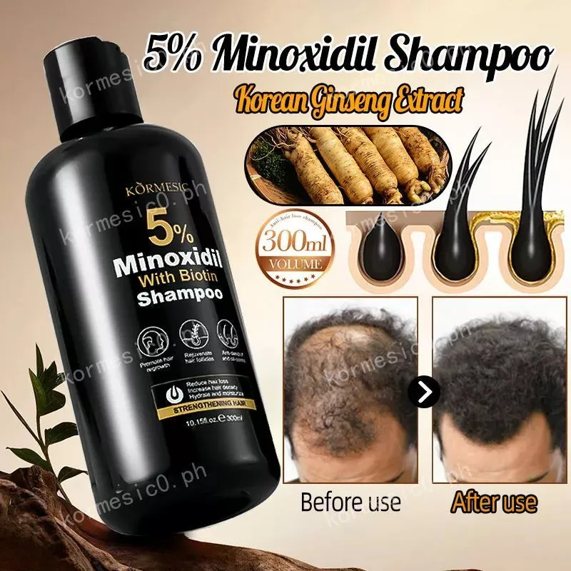 KORMESIC Minoxidil with Biotin Hair Grower Shampoo And Conditioner 300ml