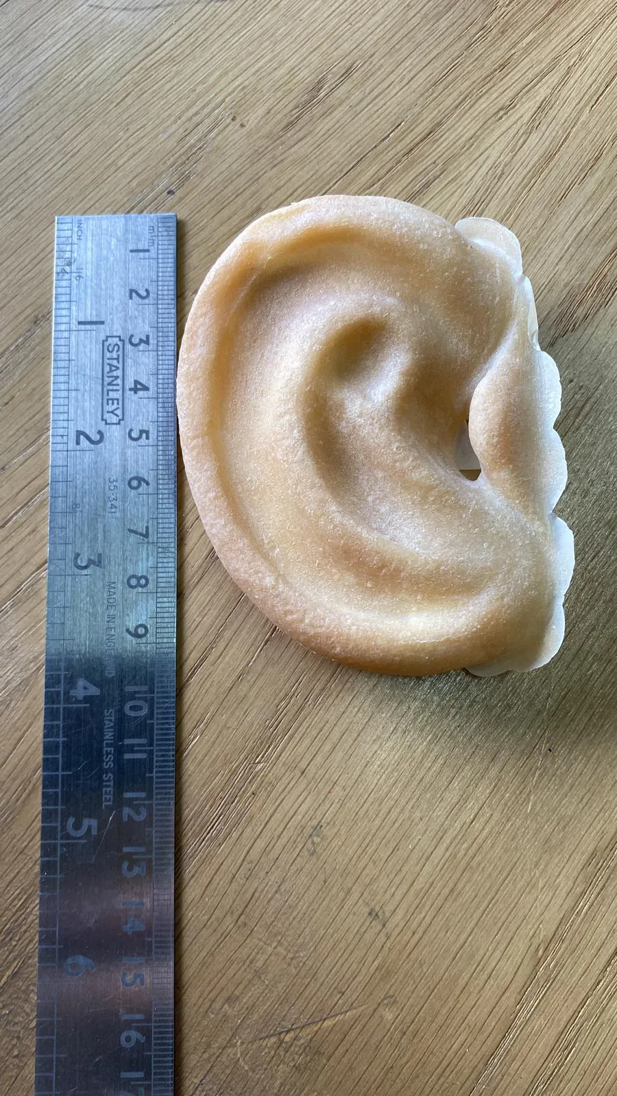 Prosthetic Big Ears